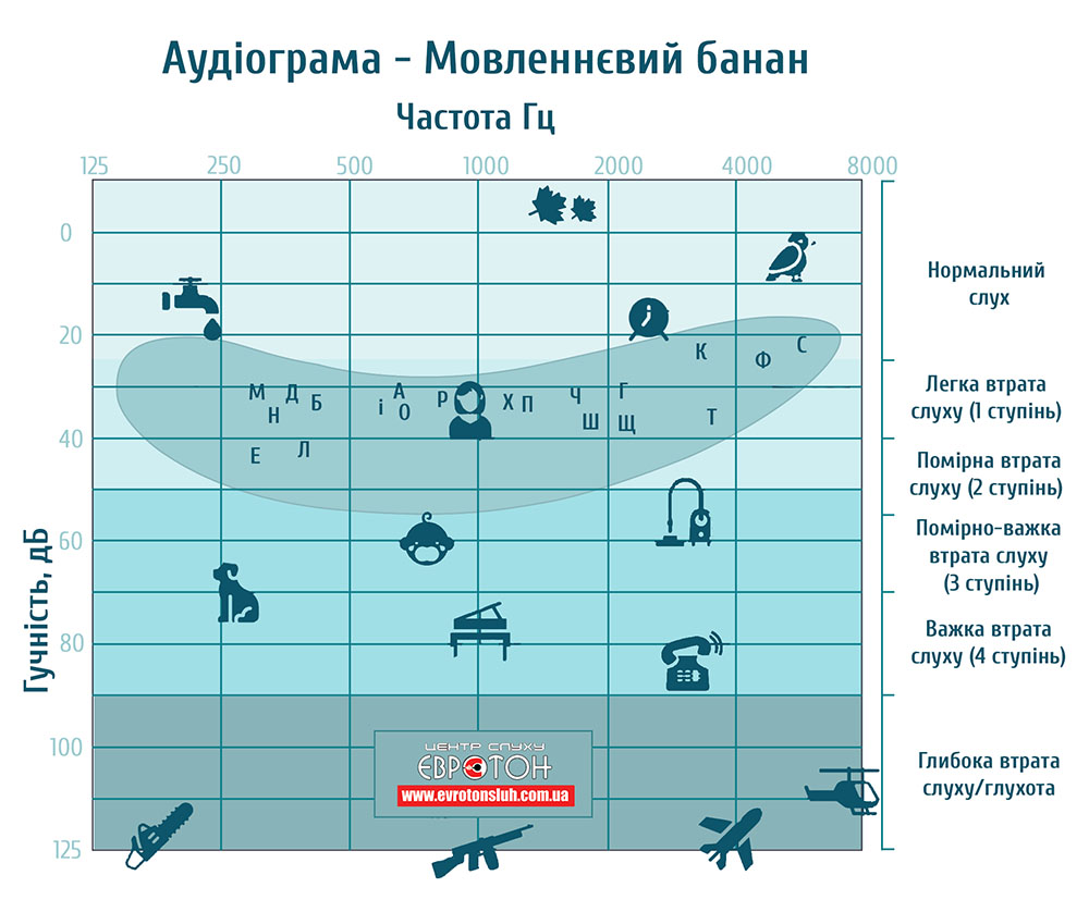Аудиограмма на которой изображен речевой банан с диапазоном в котором человек слышит повседневные звуки.